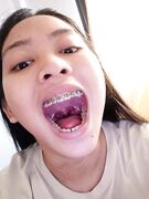 Braces girl fingers her Asian pussy